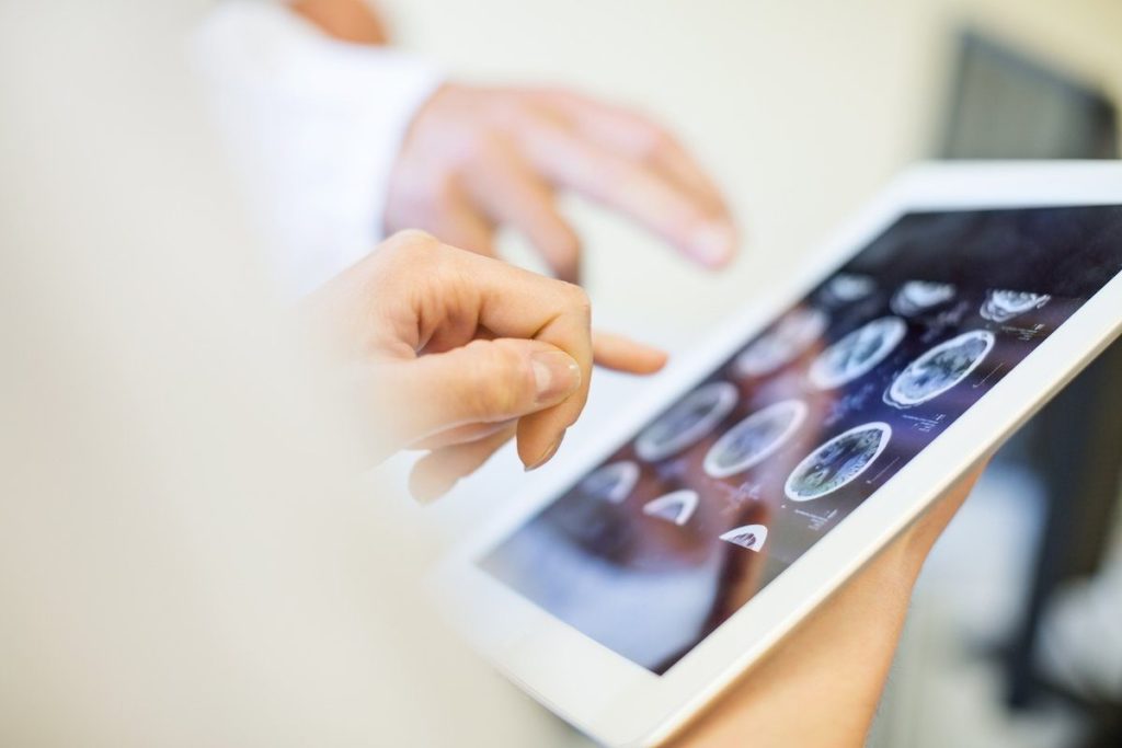 Tablet mit Bildern von Hirnscans als Beispiel für digitales Gesundheitswesen im Krankenhaus.